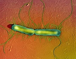 Proteus mirabilis, ceea ce este