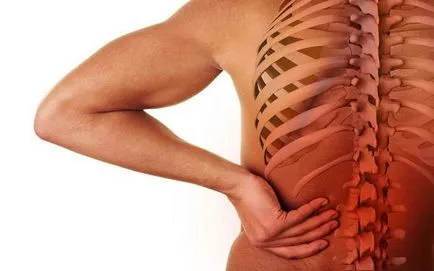 Ce este osteocondrozei comun Ce este osteocondrozei comun