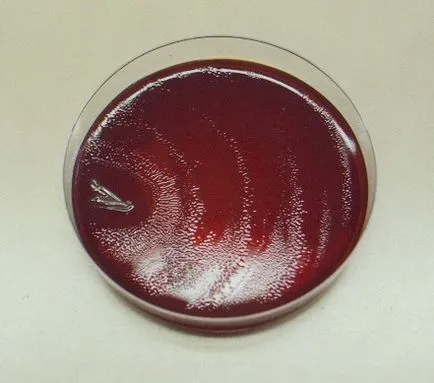 Proteus mirabilis, ceea ce este