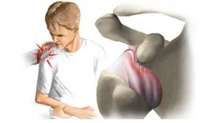 Pentru tratamentul rupturile de ligament Pentru tratamentul rupturile de ligament