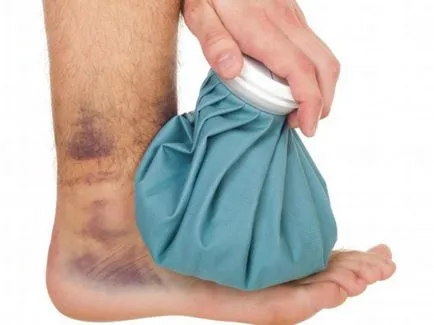 Pentru tratamentul rupturile de ligament Pentru tratamentul rupturile de ligament