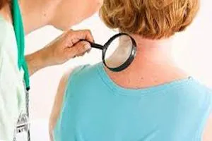 Dermatitei ce să facă Dermatitei ce să facă