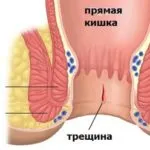 Mucusul din anus ea