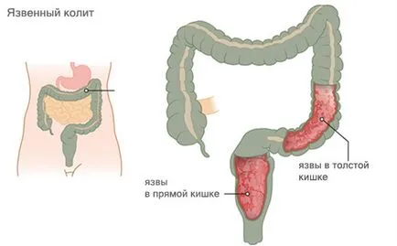 Mucusul din anus ea