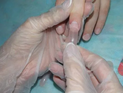 Lungire forme superioare gel