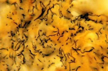 Treponema pallidum-l