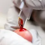 Limfocitele la copii, care este Limfocitele la copii, care este