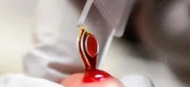 Limfocitele la copii, care este Limfocitele la copii, care este