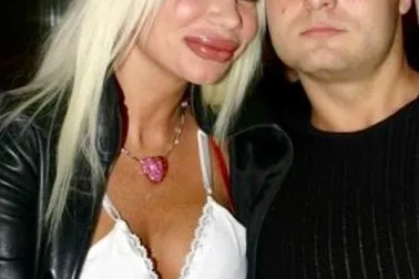 Buzele ca o rață