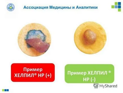 testul ureazei pozitiv ce este