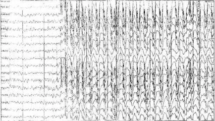 Audionarkotiki, droguri digitale, droguri audio audionarkotiki free download,