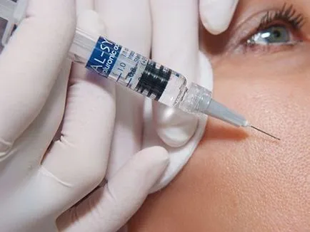 Sisteme de Biorevitalizare ISA (sistem LII) linie, principiul de funcționare, preț, recenzii cosmeticieni