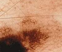 Dermatologie - preț la Moscova