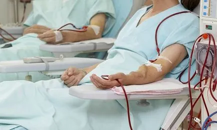 Dializa - este faptul că tipurile de dializă și caracteristicile lor