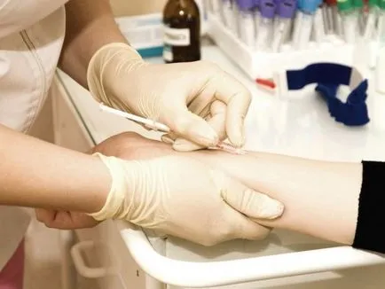 De ce testul Mantoux pentru diagnosticul tuberculozei