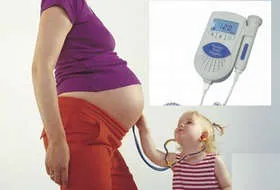 Ecografia Doppler în timpul sarcinii Doppler caracteristici, standarde, decodare, preturi