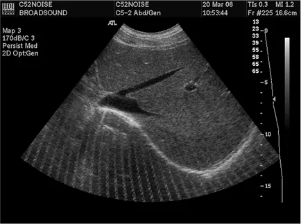 Ecografia Doppler în timpul sarcinii ce este, cum (Doppler) Ecografia Doppler în timpul sarcinii ce este, cum
