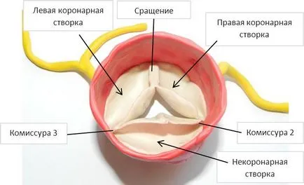 Fibroza valvei aortice