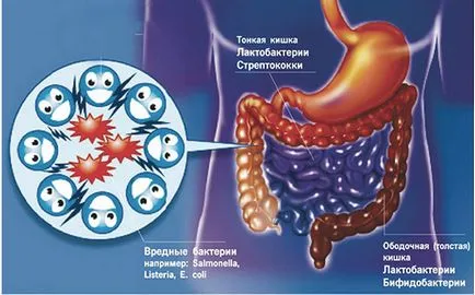 Formarea de gaze în stomac și farting ce să facă, cauze și tratament, remedii populare