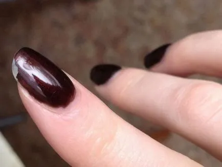 Gel unghii separă de vârfurile unghiilor și cuticulelor la baza ce să facă, motivele (gel) Gel unghii separă de vârfurile cuielor și cuticulele la baza a ceea ce să facă, motivele