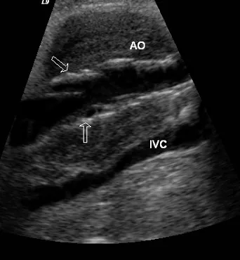 Scaun radiodiagnostic beto (departament) Departamentul de diagnosticare fascicul IPO