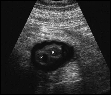 Scaun radiodiagnostic beto (diagnostic) Departamentul de diagnosticare fascicul IPO