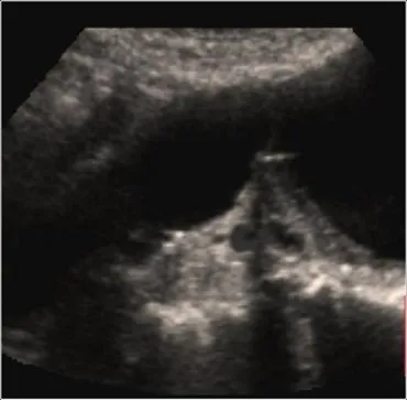 Scaun radiodiagnostic beto (diagnostic) Departamentul de diagnosticare fascicul IPO