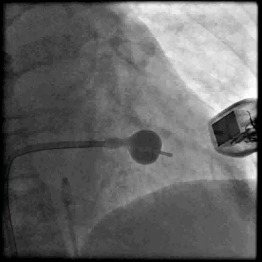 Scaun radiodiagnostic beto (departament) Departamentul de diagnosticare fascicul IPO