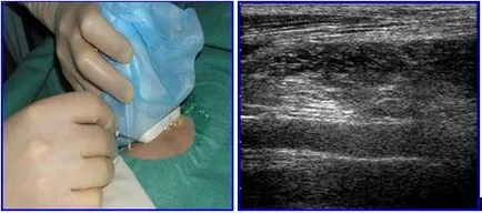 Scaun radiodiagnostic beto (departament) Departamentul de diagnosticare fascicul IPO