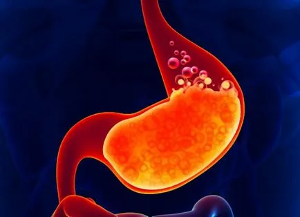 Ce este în acidul gastric uman - acid clorhidric (sare) Ce este în acidul gastric uman - acid clorhidric