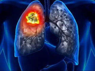 Cum să renunțe la fumat și de băut, dacă este posibil, să o faci singur (fumat) Cum să renunțe la fumat și de băut, dacă este posibil, să-l faci singur