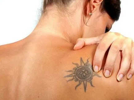 Cum și ce să aducă tatuaj tatuaj eliminate fără cicatrici - dacă este posibil
