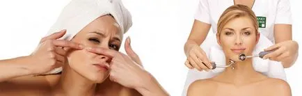 Cum sa scapi de cicatrici acnee pe fata tratament in salon si la domiciliu, revizuirea mijloace eficiente de (interior) Cum sa scapi de cicatrici acnee pe fata tratament in salon si la domiciliu, revizuirea mijloace eficiente