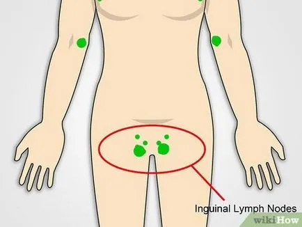 Cum de a verifica ganglionii limfatici (ganglionii limfatici inflamate din cauza) Cum de a verifica ganglionii limfatici