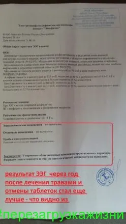 Cum de a vindeca epilepsia, o poveste adevărată a unei fete de la St. Petersburg (celule transmit reciproc) Cum de a vindeca epilepsia, o poveste adevărată a unei fete de la St. Petersburg