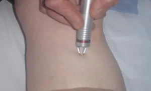 Molluscum contagiosum - tratamentul copiilor și adulților, precum și modalități de populare tradiționale