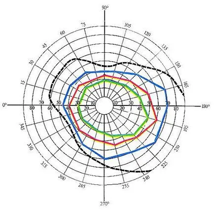 Computer perimetrie ochi - diagnosticare viziune (perimetrie calculator a ochiului) perimetrie calculator ochi - diagnosticare viziune