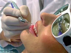 Tratamentul bolii parodontale (tratamentul periodontitei) Tratamentul bolii parodontale