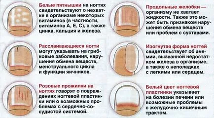 Godeurile de pe unghii