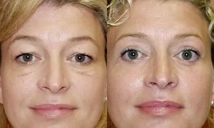 Make-up pentru secolul iminentă, timp de 5 minute