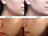 Mituri despre parafarmaceutice si marci cosmeceutical, cosmetice medicale, miturile și adevărul despre parafarmaceutice,