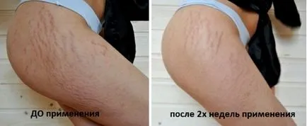 Shilajit de intindere de prescripție cremă, unguent, apoase, măști, scrubs