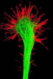 celule nervoase - este