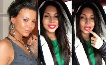 Oxana Samoilova înainte și după plastic - 300 (Samoilova) Oksana Samoilova înainte și după plastic - 300