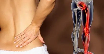 Complicațiile după accident vascular cerebral precoce și tardivă