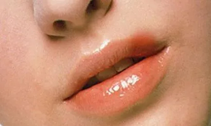Din ceea ce apare pe corpul de herpes