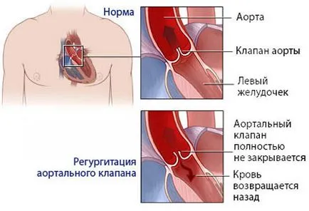 Inima tipuri de intervenții chirurgicale și indicații (funcționare) Tipuri de chirurgie cardiacă și indicații