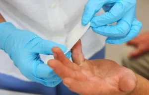 degetele de la mâini și picioare Felon - cât de repede se vindeca inflamatie si prevenirea complicatiilor (clasificare) degetele de la mâini și picioare Felon - cât de repede se vindeca inflamatie si prevenirea complicatiilor