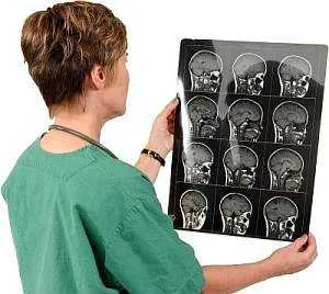 simptome cerebrale, edem cauze, alfabet de sănătate (cauza) simptome edem cerebral, cauze, alfabet de sănătate