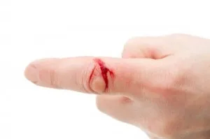 Primul ajutor pentru un deget tăiat ca o opri rapid sânge decât pentru a trata o tăietură adâncă (oprire) Primul ajutor pentru un deget tăiat ca o opri rapid sânge decât pentru a trata o tăietură adâncă